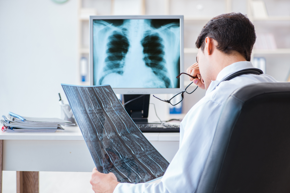 Ein Arzt betrachtet ein Röntgen-Bild