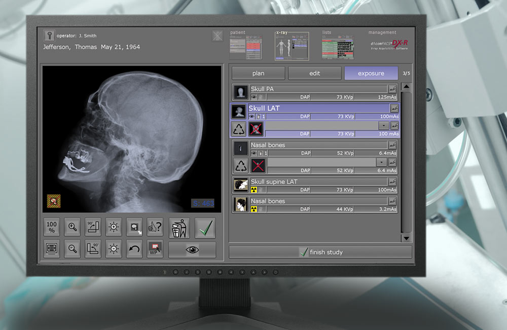 DicomPACS DX R Akquisitions-Befundsoftware