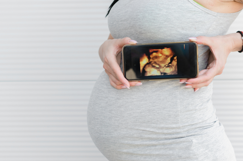 Bild: Eine Frau hält ein Handy mit einem Ultraschall-Bild vor ihren schwangeren Bauch