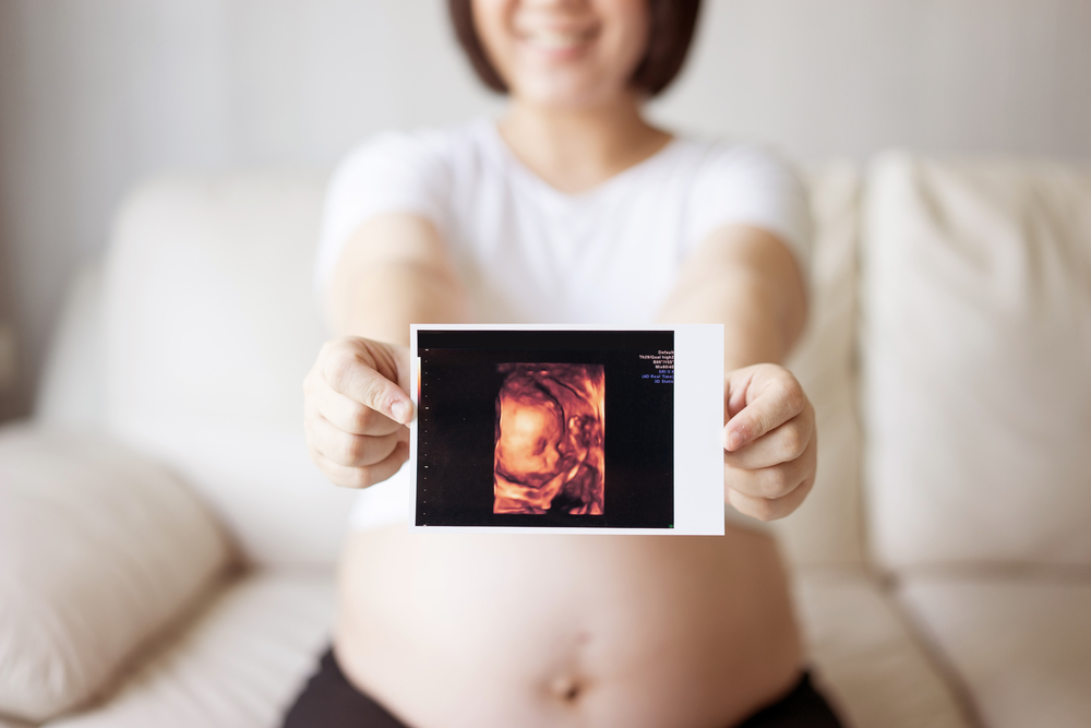 Schwangere Frau hält ein Ultraschallbild in den Händen