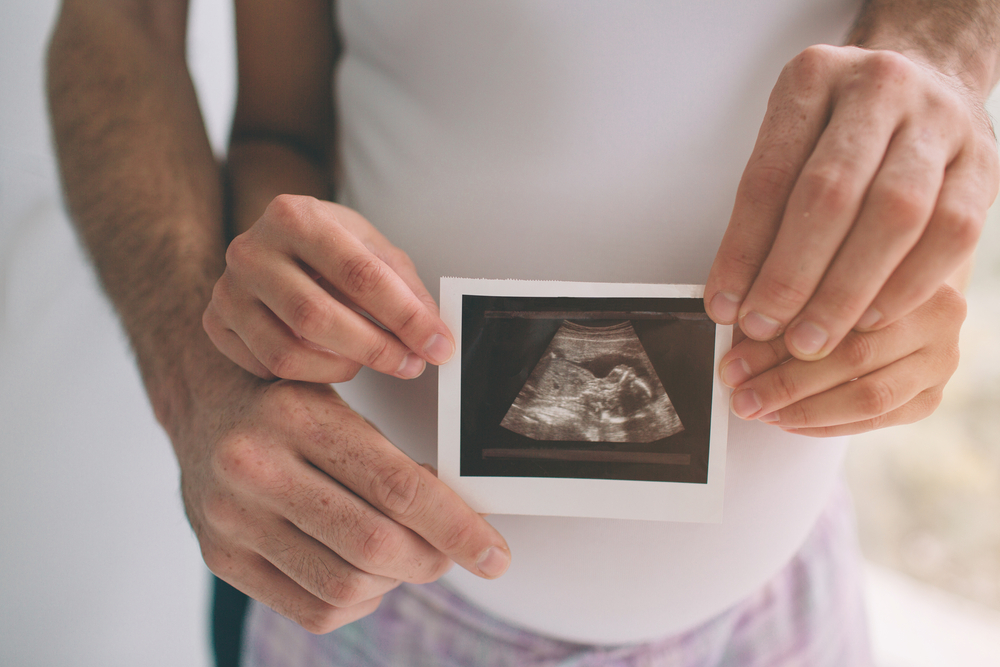 Bild: Ein Mann hält den schwangeren Bauch seiner Frau und ein 3D-Ultraschall-Bild in der Hand