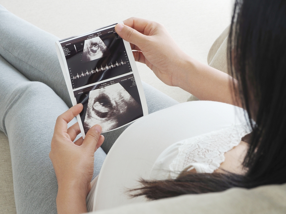 Eine schwangere Frau hält ein Ultraschall-Bild in den Händen
