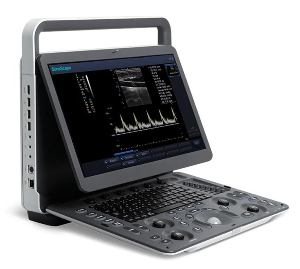 Sonoscape E1 tragbares Ultraschallgerät