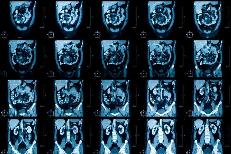 CT-Bilder vom Abdomen