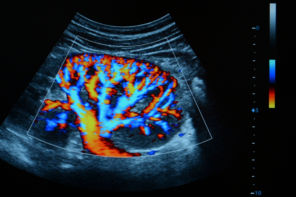 Ein farbkodiertes Dopplersonographie-Ultraschallbild der Niere.