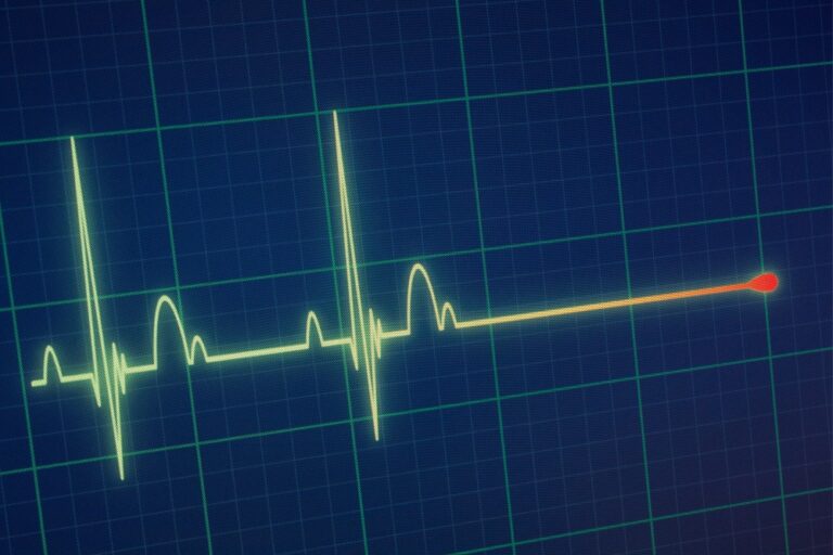 EKG-Kurven von einem Langzeit-EKG
