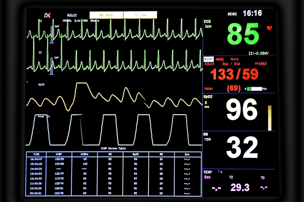 Ein Multiparameter-Patientenmonitor, der unter anderem ein EKG ableiten und den Blutdruck messen kann.