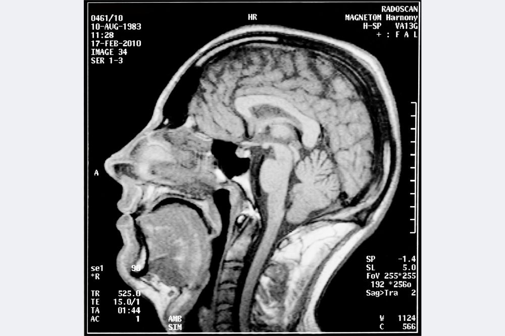 MRT-Bild vom Kopf im DICOM-Format