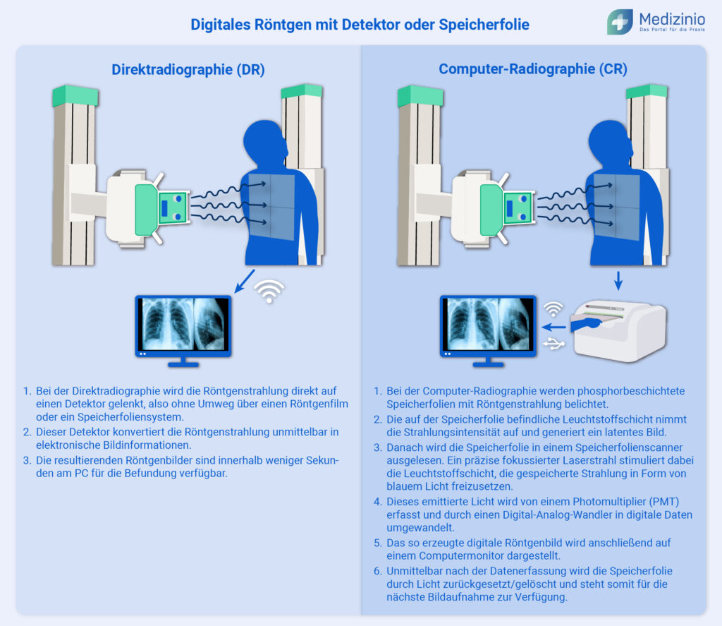 Digitales Röntgen mit Detektor oder Speicherfolie