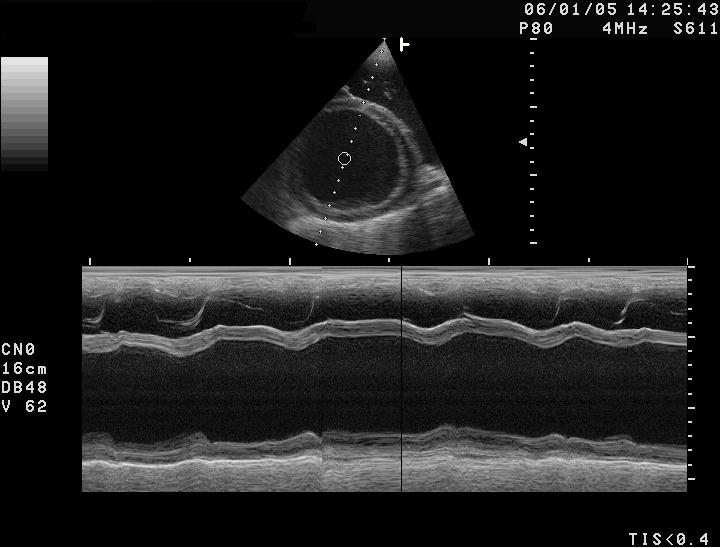 Dilatative Kardiomyopathie im M-Mode-Ultraschallbild bei einem Hund.