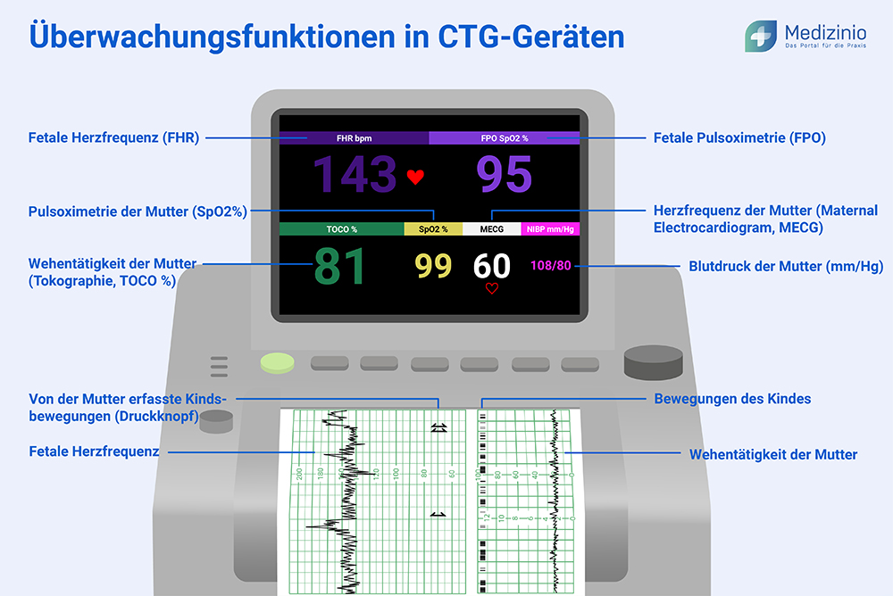 Erklärung der Funktionen eines CTG-Gerätes