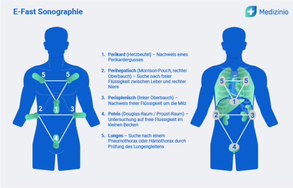 Pocus-Ultraschall in der Medizin: Ein Überblick